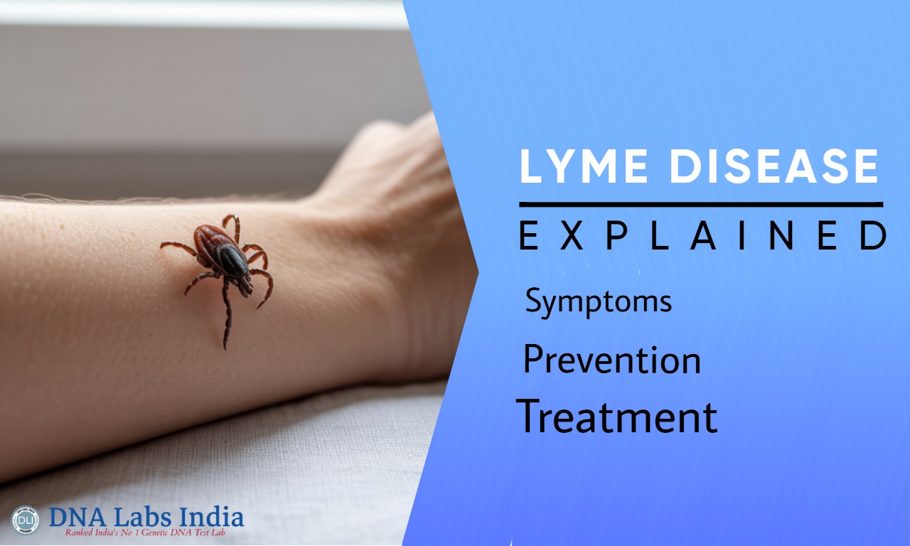 Lyme Disease: Symptoms, Diagnosis, Treatment & Prevention